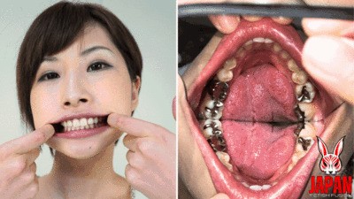Teeth Inspection Chronicles: Dive into Yua Hidaka's Enigmatic Oral Realm