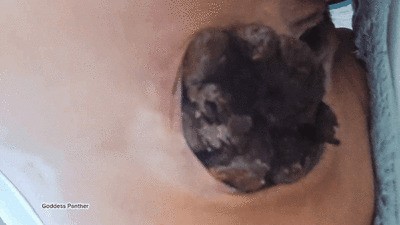 Struggling with Massive, Painful Blockages