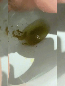 An Unwelcome Stomach Bug