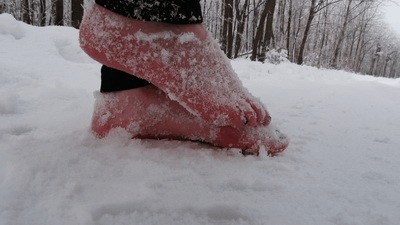 Frostbitten Feet