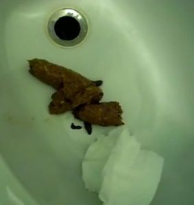 Big Surprise in the Bidet