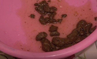 Girl doing an enema and shit in the bowl.